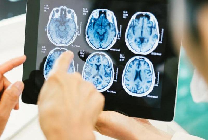 چه مواردی خطر ابتلا به عفونت مغزی را بالا می‌برد؟