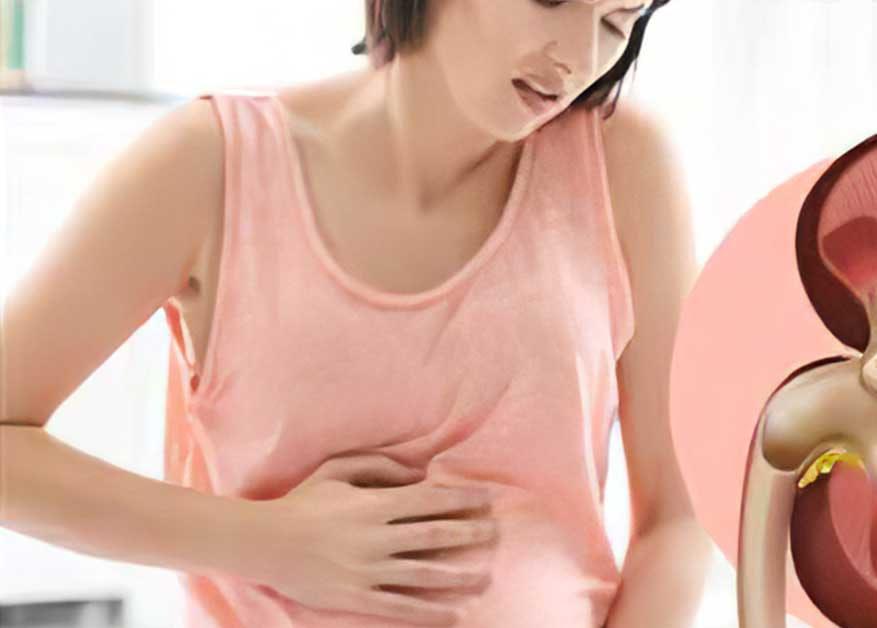 علل بروز سنگ کلیه در بارداری
