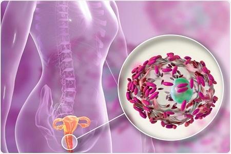 خارش واژن قبل از پریود: علل ، تشخیص و درمان