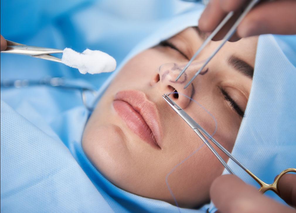 مرگ بر اثر جراحی بینی ممکن است؟